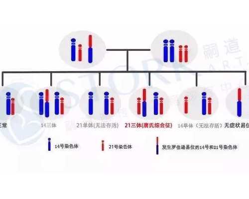 乌克兰试管婴儿生儿子,(乌克兰做试管)乌克兰试管婴儿医院怎么选